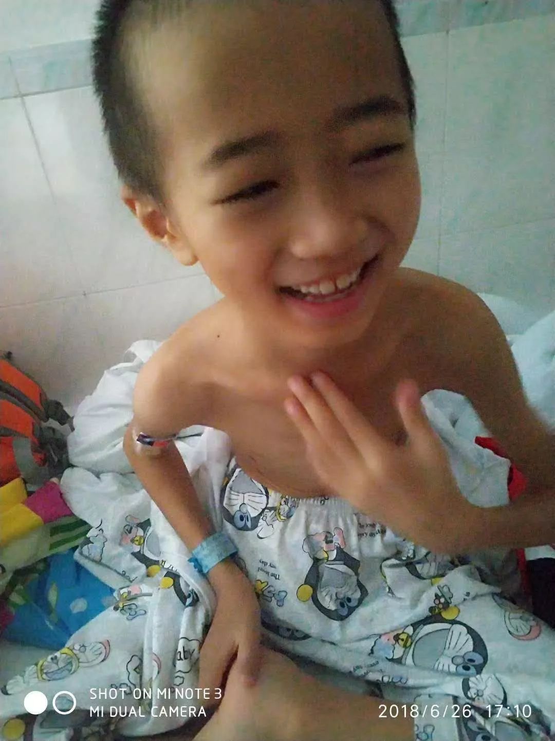 孩子患髓母细胞瘤,10岁儿童髓母瘤能彻底治愈吗