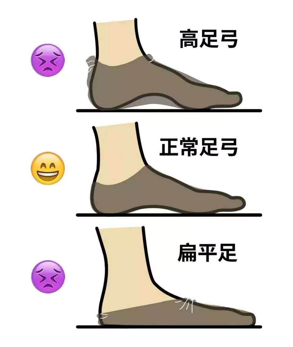 袜子掉跟小妙招怎么解决,袜子老是掉下去怎么办