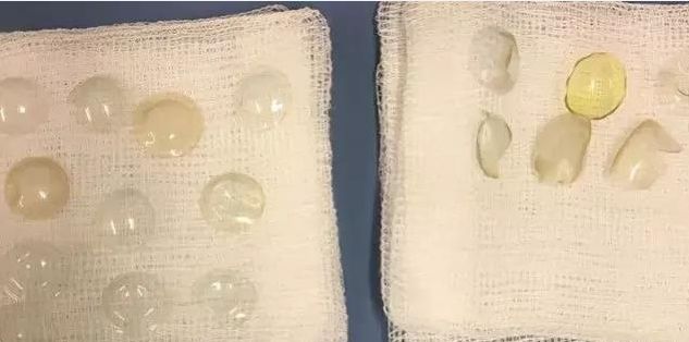 经常戴隐形眼镜真的不好吗,经常戴隐形眼镜有什么不好