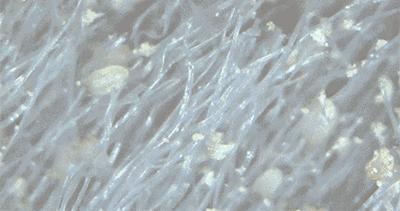 你晒被子10次，比不上我用它喷一回！除螨99%，裸睡都可以