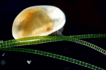 显微镜看到的藻类微生物形态图,藻类浮游生物