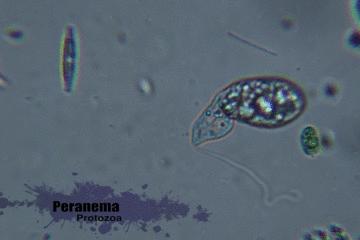 显微镜看到的藻类微生物形态图,藻类浮游生物