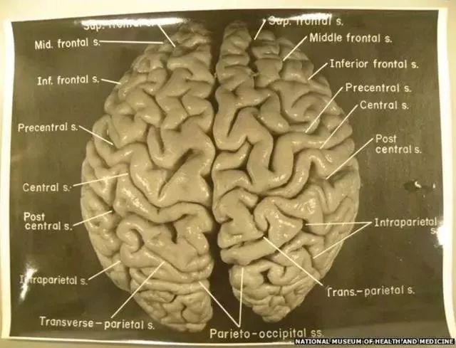 大家的脑子里都是100多亿个神经元，为什么TA就是高考状元？