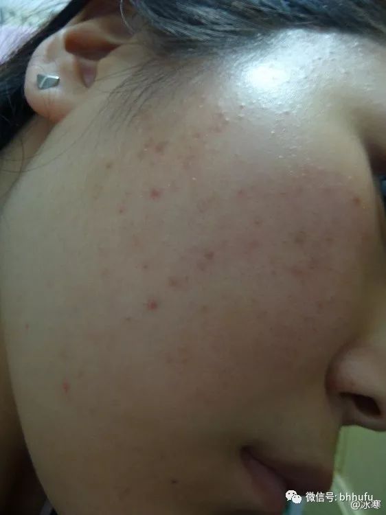 闭口看得出来吗,你真的知道什么是闭口吗