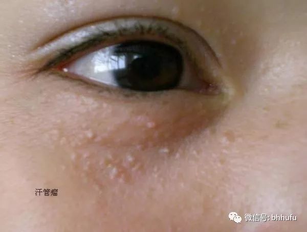 闭口看得出来吗,你真的知道什么是闭口吗