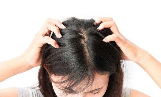 头发渐渐离开,头发离开了头皮会枯萎么