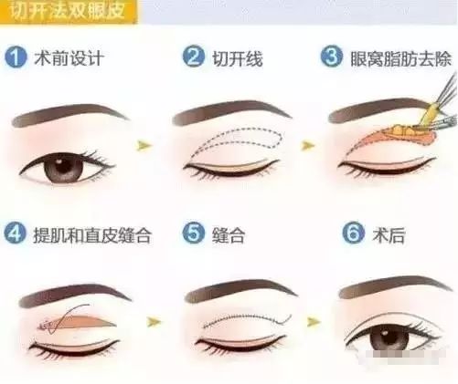 一双眼睛会拯救一张脸吗,一双眼睛是否能拯救一张脸