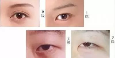 一双漂亮眼睛能拯救一张脸,一双眼睛真的能拯救整张脸