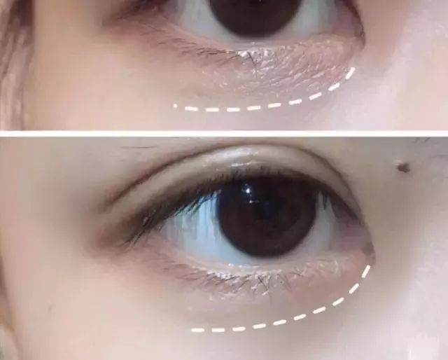 中国年轻人最爱的德国原装进口眼霜!请加入你们双十一的购物清单