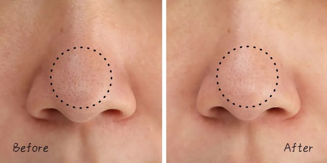 不做清洁面膜护肤品能吸收吗,不做清洁补水有效果吗