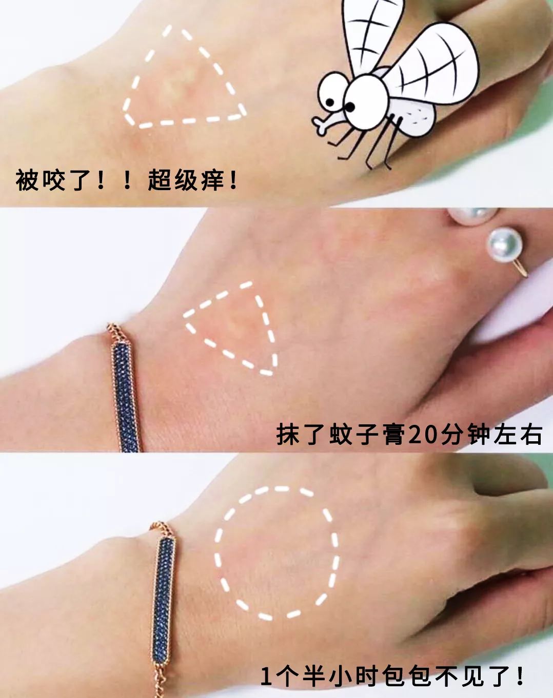 一小瓶止痒的药膏,一小瓶药水止痒叫什么