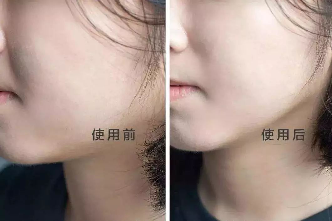 黑科技一秒祛斑,黑科技美白真的有效吗