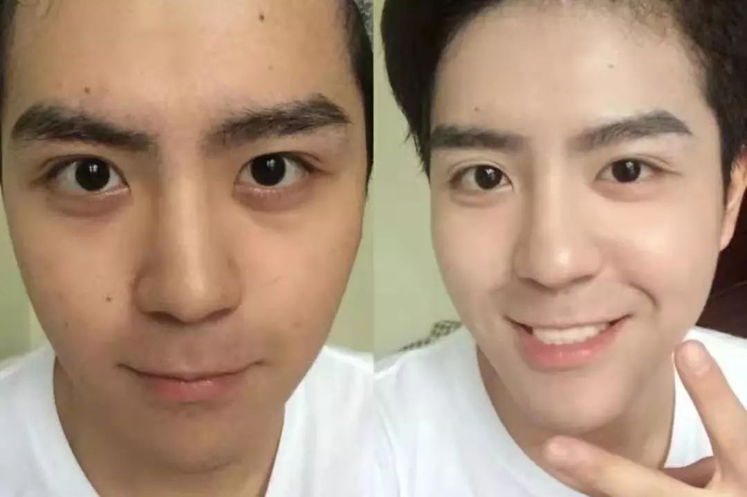 黑科技一秒祛斑,黑科技美白真的有效吗