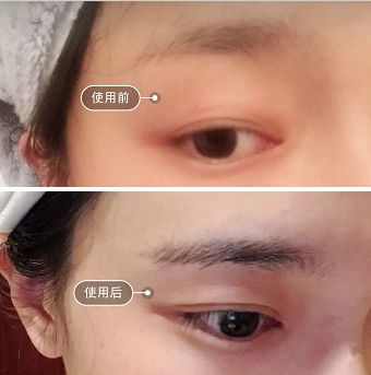 纹眉一周后眉毛还没完全掉痂,纹眉之后我的眉毛不长了