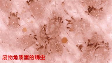 柔嫩抛光|脸上搓出3斤泥！难怪又黄又暗又黑头！10秒给脸蛋“剥壳”，厉害