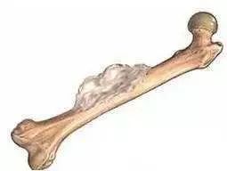 癌症防治核心信息及知识要点,最详细的癌症讲解看完受益终身