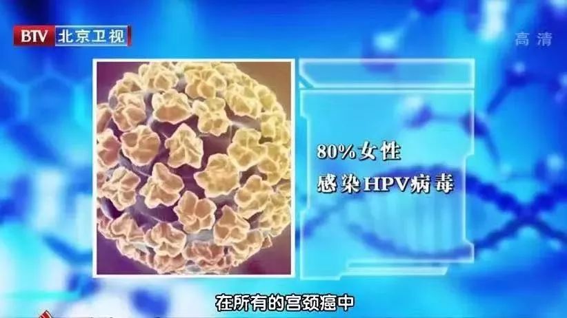 妇科疾病的筛查方法有哪些,妇科病检查提前准备事项有哪些