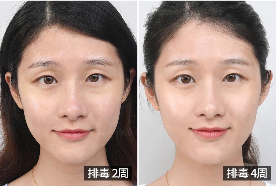 宋慧乔大长今李英爱,39岁宋慧乔完美复出御姐范十足