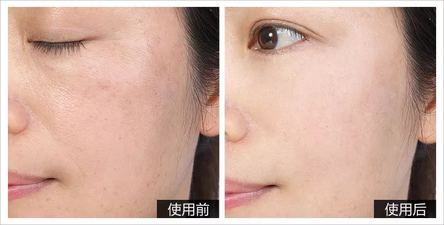 宋慧乔金喜善大长今,大长今金喜善宋慧乔