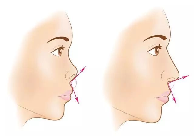 6种整容级鼻型修容法,6种鼻型矫正画法