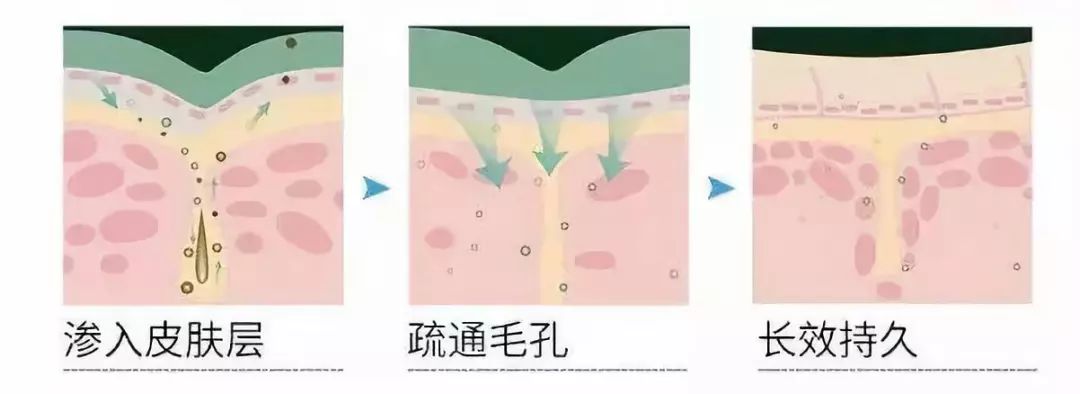 治脚气干裂起皮用什么药膏,有这个方子来治脚气就不怕复发