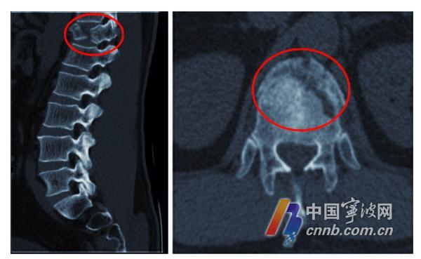 台风来了货车司机被压死,台风来袭司机开车险被大树砸中