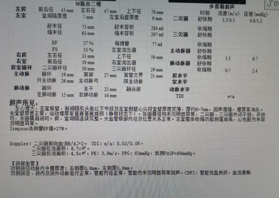 缺血性心脏病吃哪些中成药,心肌缺血合并心衰吃什么恢复得快
