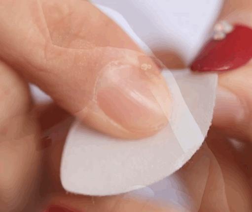 35岁了法令纹鱼尾纹眉间纹怎么办,三十岁就有眉间纹法令纹怎么办