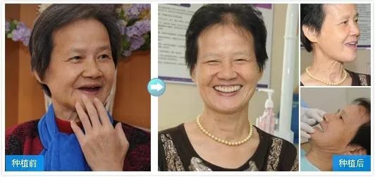 福州市民凭身份证免费牙齿矫正,身份证520开头免票