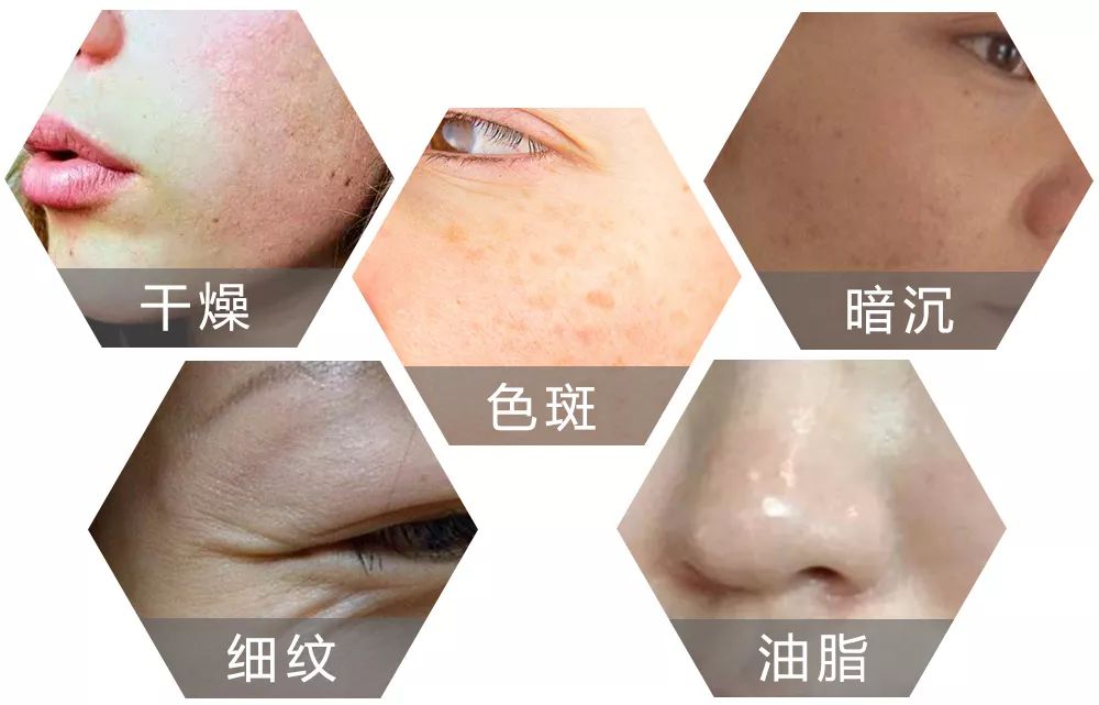 用它洗脸，脏东西自己浮出来，比做10次面膜还管用！丨开团