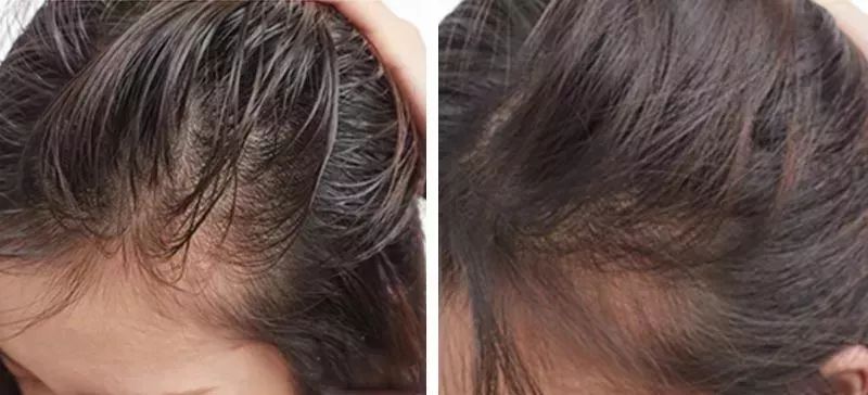 口臭推荐真实测评,白开水加一物去除口臭