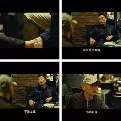 这样的痣可能变成癌中之王？把痣点掉能预防吗？