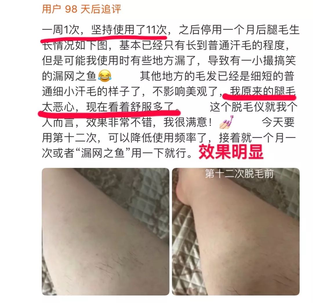 不要错过脱毛好季节,别再错过脱毛最佳季节