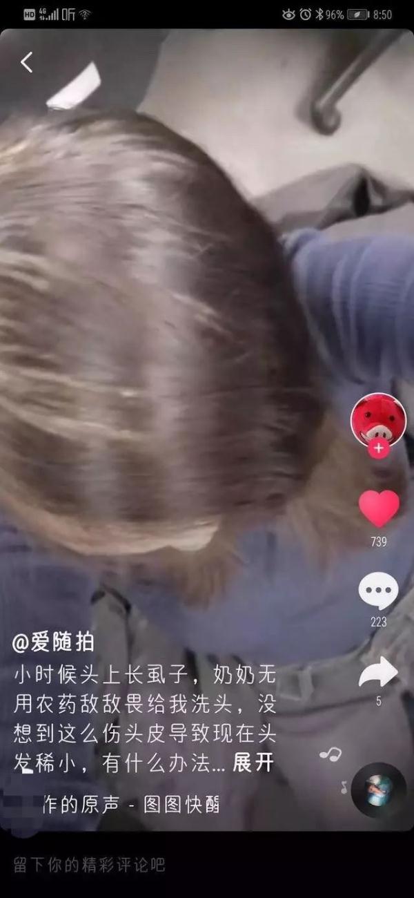 敌敌畏洗头杀跳蚤,敌敌畏杀跳蚤彻底吗