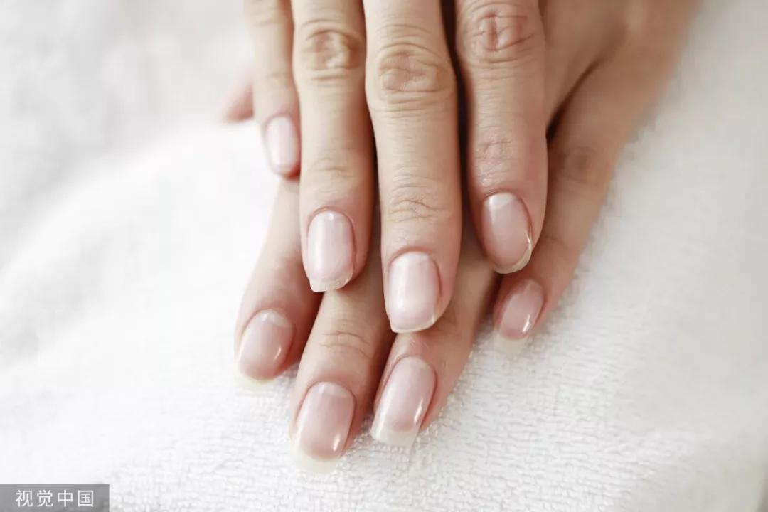 指甲月牙是人体健康的晴雨表,指甲的月牙体现身体状况