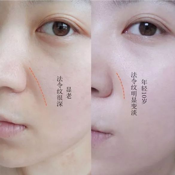 这款急救弹性蛋白贴，每天一片赶走干纹，还你天鹅美颈