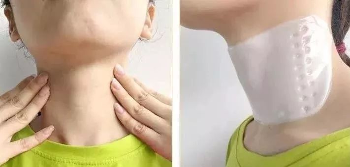 这款急救弹性蛋白贴，每天一片赶走干纹，还你天鹅美颈