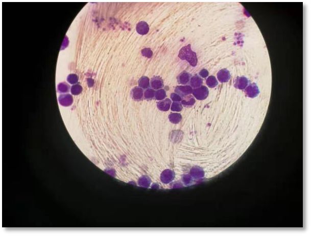 捐献干细胞详细过程感谢信,造血干细胞移植合集