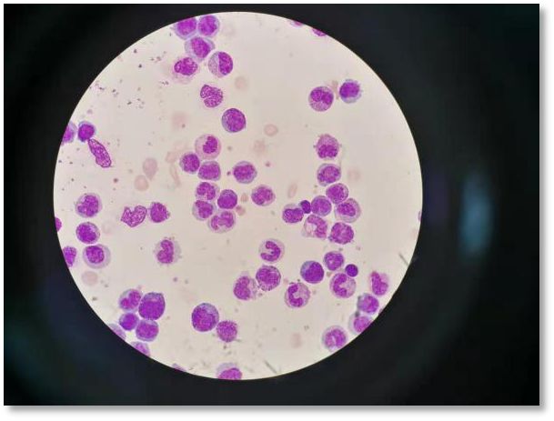 捐献干细胞详细过程感谢信,造血干细胞移植合集