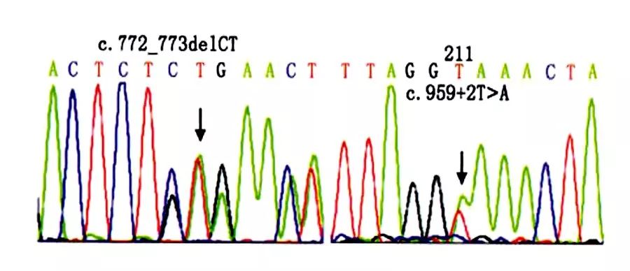 面部蝶形红斑一定是红斑狼疮吗,面颈部环状红斑是什么原因引起的