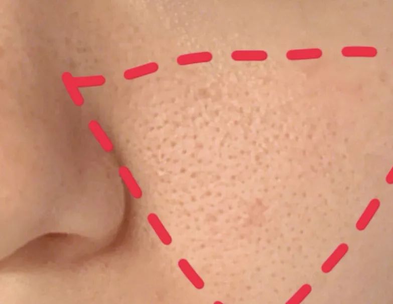 冬季干燥持久补水喷雾300ml保湿,补水喷雾巨补水秋冬