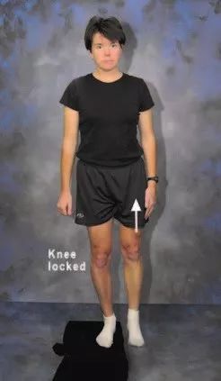 璺戞鑰呰啙,璺戞鑰呰啙鐤兼槸鎬庝箞鍥炰簨