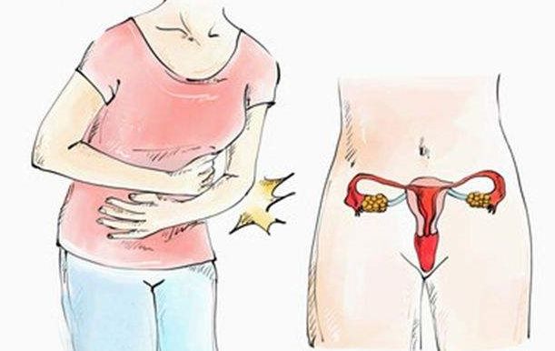 带你认知子宫肌瘤