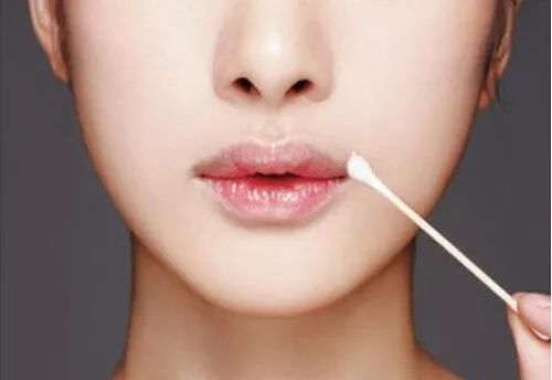 嘴唇干裂起皮怎么撕掉,嘴唇干裂脱皮润唇膏做法
