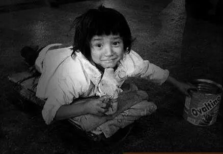 眼球被挖的人后续,眼球被挖了之后眼皮还能睁开吗