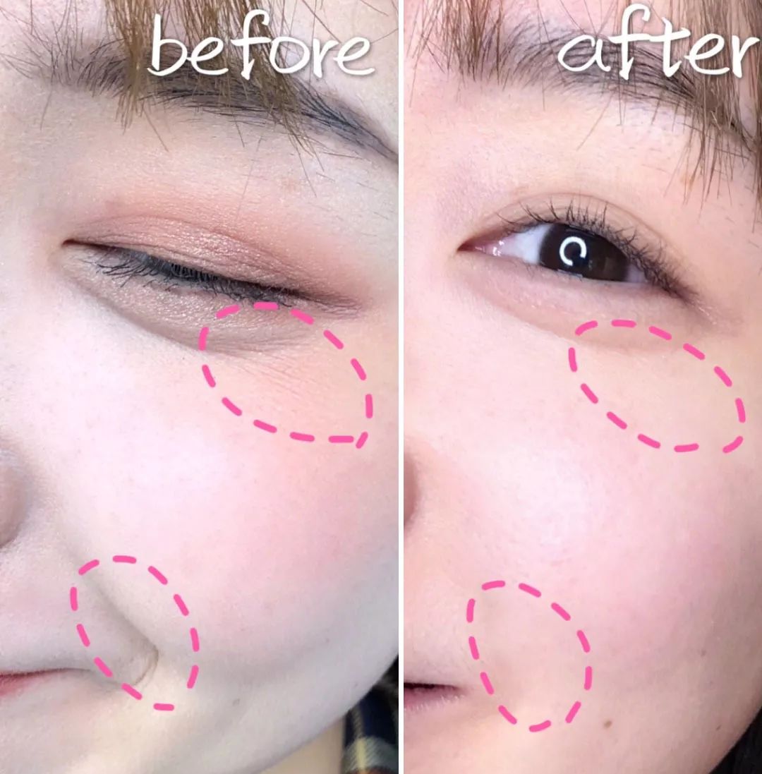 法令纹眼纹一个都逃不掉,法令纹和眼纹怎么才能有效改善