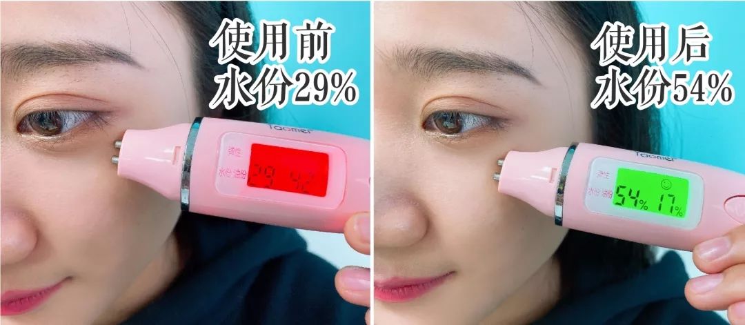 法令纹和眼纹怎么才能有效改善,法令纹贴眼贴有用吗