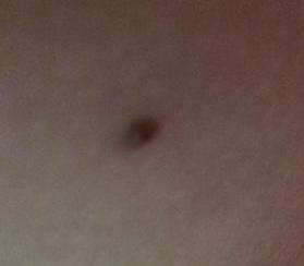 祛斑最有效是仪器还是产品,公认的祛斑第一名食物