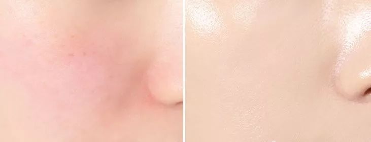 澳皙可涂抹面膜,澳皙可海藻面膜适合什么肤质