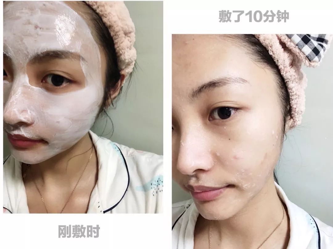 急救面膜意大利,意大利医用补水面膜